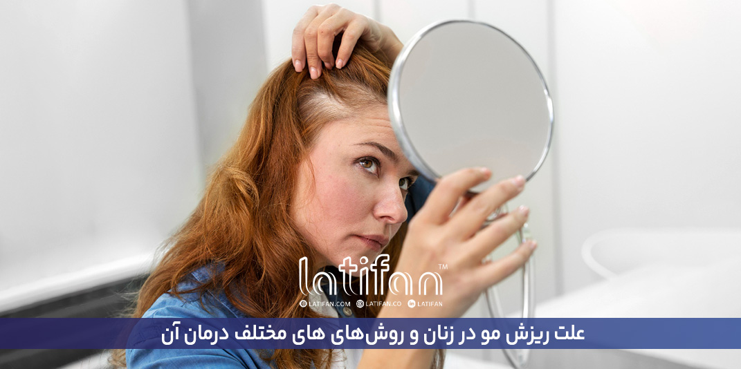 علت ریزش مو در زنان و روش‌های های مختلف درمان آن 